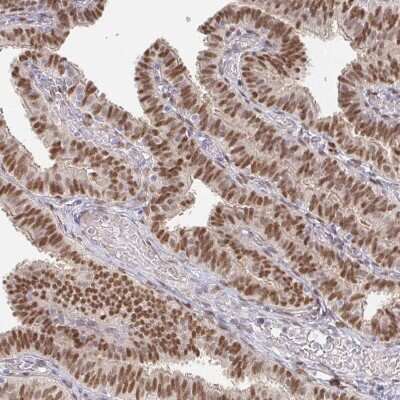 Immunohistochemistry-Paraffin: MEIS1 Antibody [NBP2-38776] - Staining of human Fallopian tube shows moderate nuclear positivity in glandular cells.