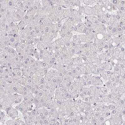 Immunohistochemistry-Paraffin: MEIS1 Antibody [NBP2-38776] - Staining of human liver shows no positivity in hepatocytes as expected.