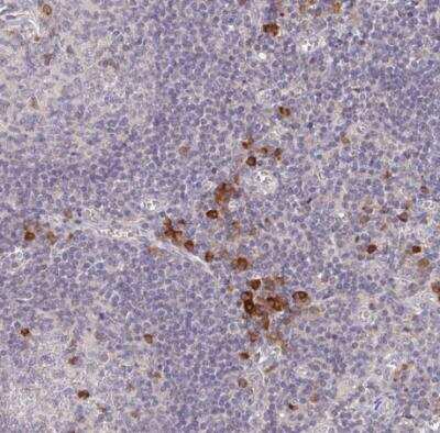 Immunohistochemistry-Paraffin: MEIS1 Antibody [NBP2-38776] - Staining of human lymph node shows strong cytoplasmic positivity in a subset of  non germinal center cells.