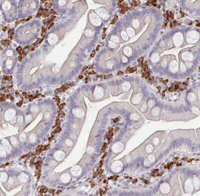 Immunohistochemistry-Paraffin: MEIS1 Antibody [NBP2-38776] - Staining of human small intestine shows strong cytoplasmic postivity in lymphoid cells.