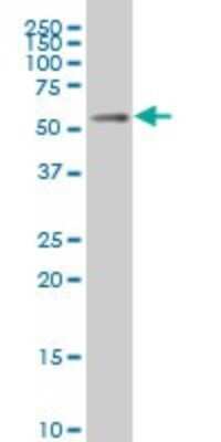Western Blot: MEIS2 Antibody (1B3) [H00004212-M02] - MEIS2 monoclonal antibody (M02), clone 1B3. Analysis of MEIS2 expression in IMR-32.