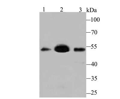 Western Blot: MEIS2 Antibody (JB40-38) [NBP2-75571] - Analysis of MEIS2 on different lysates using anti-MEIS2 antibody at 1/500 dilution.Positive control:Lane 1: Mouse testis    Lane 2: SH-SY-5YLane 3: Mouse lung