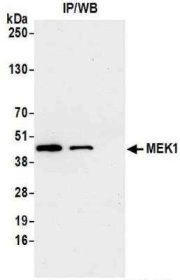 Immunoprecipitation: MEK1 Antibody [NBP3-14688] - : Whole cell lysate (1.0 mgper IP reaction; 20% of IP loaded) from HeLa cells preparedusing NETN lysis buffer. Antibodies: Rabbit anti-MEK1recombinant monoclonal antibody used for IP at 20 ul/mg lysate. MEK1 was alsoimmunoprecipitated by rabbit anti-MEK1 recombinantmonoclonal antibody. For blottingimmunoprecipitated MEK1, was used at 1:1000.Chemiluminescence with an exposure time of 30 seconds.