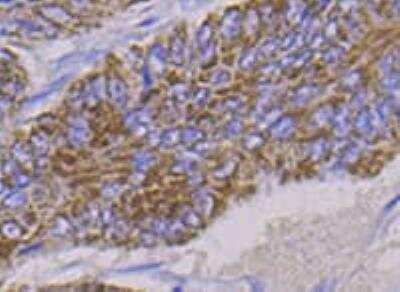Immunohistochemistry-Paraffin: MEK1 [p Ser298] Antibody (SD206-7) [NBP2-67770] - Analysis of paraffin-embedded mouse colon tissue using MEK1 [p Ser298] antibody. Image from verified customer review.