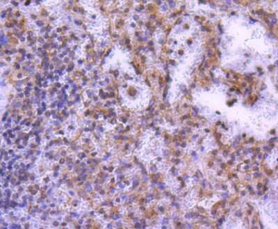 Immunohistochemistry-Paraffin: MEK2 Antibody (SD207-08) [NBP2-67791] - Analysis of paraffin-embedded human spleen tissue using anti-MEK2 antibody. Counter stained with hematoxylin.
