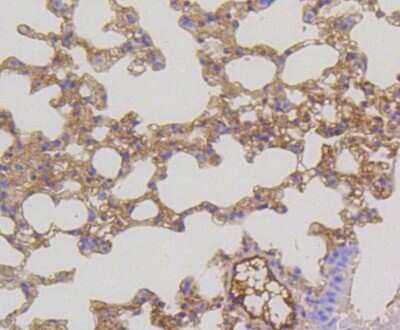 Immunohistochemistry-Paraffin: MEK2 Antibody (SR13-07) [NBP2-67332] - Analysis of paraffin-embedded mouse lung tissue using anti-MEK1/2 antibody. Counter stained with hematoxylin.