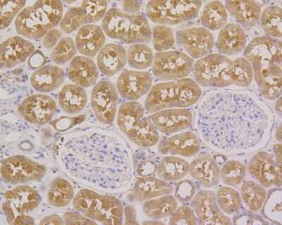 Immunohistochemistry-Paraffin: MEK2 Antibody (SR13-07) [NBP2-67332] - Immunohistochemical analysis of paraffin-embedded human kidney tissue using anti-MEK2 antibody. The section was pre-treated using heat mediated antigen retrieval with Tris-EDTA buffer (pH 8.0-8.4) for 20 minutes. The tissues were blocked in 5% BSA for 30 minutes at room temperature, washed with ddH2O and PBS, and then probed with the primary antibody (ET1602-3, 1/50) for 30 minutes at room temperature. The detection was performed using an HRP conjugated compact polymer system. DAB was used as the chromogen. Tissues were counterstained with hematoxylin and mounted with DPX.