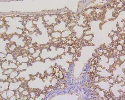 Immunohistochemistry-Paraffin: MEK2 Antibody (SR13-07) [NBP2-67332] - Immunohistochemical analysis of paraffin-embedded mouse lung tissue using anti-MEK2 antibody. The section was pre-treated using heat mediated antigen retrieval with Tris-EDTA buffer (pH 8.0-8.4) for 20 minutes. The tissues were blocked in 5% BSA for 30 minutes at room temperature, washed with ddH2O and PBS, and then probed with the primary antibody (ET1602-3, 1/200) for 30 minutes at room temperature. The detection was performed using an HRP conjugated compact polymer system. DAB was used as the chromogen. Tissues were counterstained with hematoxylin and mounted with DPX.