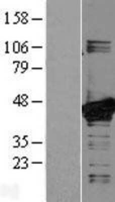 Western Blot: MEK3 Overexpression Lysate (Adult Normal) [NBL1-12848] Left-Empty vector transfected control cell lysate (HEK293 cell lysate); Right -Over-expression Lysate for MEK3.