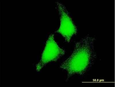 Immunocytochemistry/Immunofluorescence: MEK5 Antibody (1E5) [H00005607-M03] - Analysis of monoclonal antibody to MAP2K5 on HeLa cell. Antibody concentration 10 ug/ml