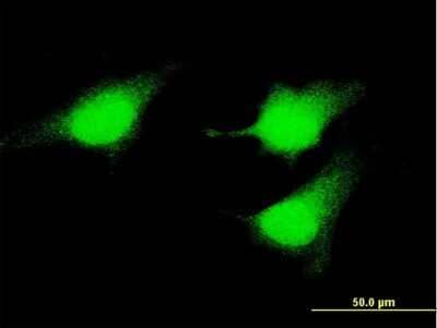 Immunocytochemistry/Immunofluorescence: MEK5 Antibody (2C2) [H00005607-M04] - Analysis of monoclonal antibody to MAP2K5 on HeLa cell. Antibody concentration 10 ug/ml