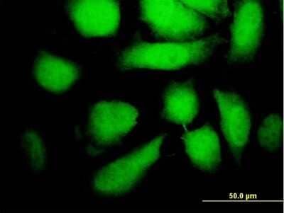 Immunocytochemistry/Immunofluorescence: MEK5 Antibody (3E10) [H00005607-M11] - Analysis of monoclonal antibody to MAP2K5 on HeLa cell. Antibody concentration 10 ug/ml