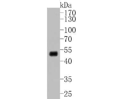 Western Blot: MEK5 Antibody (SD208-6) [NBP2-67763] - Western blot analysis of MEK5 on Hela cell lysates. Proteins were transferred to a PVDF membrane and blocked with 5% BSA in PBS for 1 hour at room temperature. The primary antibody (1/500) was used in 5% BSA at room temperature for 2 hours. Goat Anti-Rabb