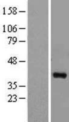 Western Blot: MEK6 Overexpression Lysate (Adult Normal) [NBL1-12851] Left-Empty vector transfected control cell lysate (HEK293 cell lysate); Right -Over-expression Lysate for MEK6.