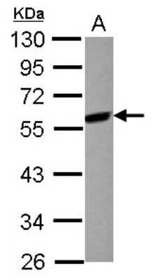 Western Blot: MEK7 Antibody [NBP2-17272] - Sample (30 ug of whole cell lysate) A: Raji 10% SDS PAGE gel, diluted at 1:1000.