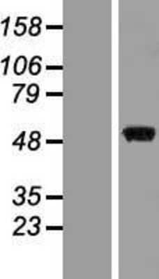 Western Blot: MEK7 Overexpression Lysate (Adult Normal) [NBP2-05503] Left-Empty vector transfected control cell lysate (HEK293 cell lysate); Right -Over-expression Lysate for MEK7.