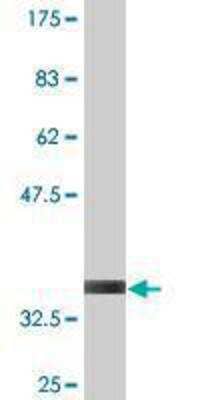 Western Blot: MEKK3 Antibody (1H3) [H00004215-M10] - detection against Immunogen (35.9 KDa) .