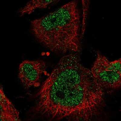 Immunocytochemistry/Immunofluorescence: MEKK3 Antibody [NBP2-58303] - Staining of human cell line U-251 MG shows localization to nucleoplasm.