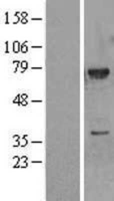 Western Blot: MEKK3 Overexpression Lysate (Adult Normal) [NBL1-12855] Left-Empty vector transfected control cell lysate (HEK293 cell lysate); Right -Over-expression Lysate for MEKK3.