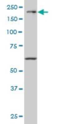 Western Blot: MEKK4 Antibody (6C6) [H00004216-M02] - MAP3K4 monoclonal antibody (M02), clone 6C6 Analysis of MAP3K4 expression in NIH/3T3.