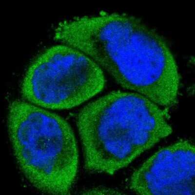 Immunocytochemistry/Immunofluorescence: MEKK4 Antibody [NBP1-87734] - Staining of human cell line A-431 shows localization to cytosol.