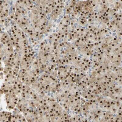 Immunohistochemistry-Paraffin: MEKK4 Antibody [NBP1-87734] - Staining of human pancreas shows strong nuclear and moderate cytoplasmic positivity in exocrine glandular cells.