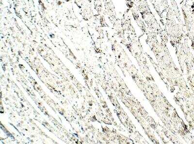 Immunohistochemistry-Paraffin: MEKK4 Antibody [NBP3-12324] - Mouse Heart. 1:50 dilution in IHC blocking buffer. DAB (brown) staining Hematoxylin QS (blue) counterstain. 10X magnification.