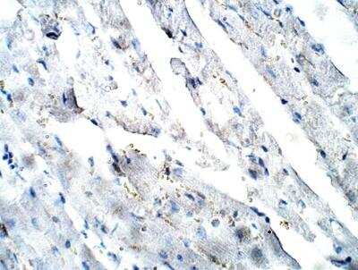 Immunohistochemistry-Paraffin MEKK4 Antibody