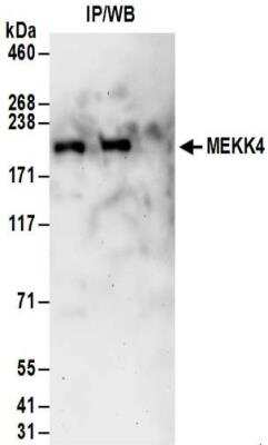 Immunoprecipitation: MEKK4 Antibody [NBP2-32187] - Samples:  Whole cell lysate (0.5 or 1.0 mg per IP reaction; 20% of IP loaded) from 293T cells. Antibodies:  Affinity purified rabbit anti-MEKK4 antibody NBP2-32187 used for IP at 6 ug per reaction. MEKK4 was also immunoprecipitated by rabbit anti-MEKK4 antibody BL15818. For blotting immunoprecipitated MEKK4, NBP2-32187 was used at 1 ug/ml.  Detection: Chemiluminescence with an exposure time of 3 minutes.
