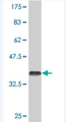 Western Blot: MEL-18 Antibody (3E4.) [H00007703-M06] - Detection against Immunogen (32.23 KDa) .