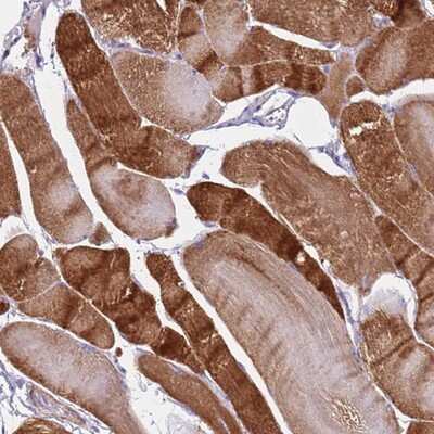 Immunohistochemistry-Paraffin: MEL-18 Antibody [NBP2-13739] Staining of human skeletal muscle shows strong cytoplasmic positivity in myocytes.