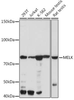 Western Blot: MELK Antibody (4F10X4) [NBP3-16211] - Western blot analysis of extracts of various cell lines, using MELK Rabbit mAb (NBP3-16211) at 1:1000 dilution. Secondary antibody: HRP Goat Anti-Rabbit IgG (H+L) at 1:10000 dilution. Lysates/proteins: 25ug per lane. Blocking buffer: 3% nonfat dry milk in TBST. Detection: ECL Basic Kit. Exposure time: 1min.