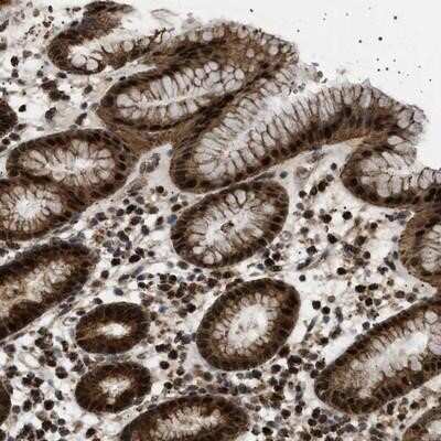 Immunohistochemistry-Paraffin: MELK Antibody [NBP1-83031] - Staining of human stomach shows strong cytoplasmic and nuclear positivity in glandular cells.