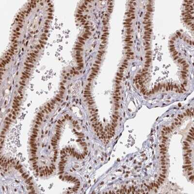 Immunohistochemistry-Paraffin: MEPCE Antibody [NBP2-33619] - Staining of human fallopian tube shows strong nuclear positivity in glandular cells.