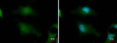 Immunocytochemistry/Immunofluorescence: MERIT40/HSPC142 Antibody (1251) [NBP2-43621] - Analysis of Sample: HeLa cells were fixed in 4% paraformaldehyde at RT for 15 min. Green: MERIT40/HSPC142 protein stained by MERIT40/HSPC142 antibody [1251] diluted at 1:500. Blue: Hoechst 33342 staining.