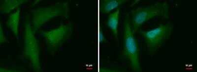 Immunocytochemistry/Immunofluorescence: MERIT40/HSPC142 Antibody (2810) [NBP2-43622] - Analysis of Sample: HeLa cells were fixed in 4% paraformaldehyde at RT for 15 min. Green: C19orf62 protein stained by C19orf62 antibody [2810] diluted at 1:500. Blue: Hoechst 33342 staining.