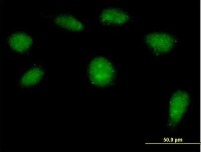 Immunocytochemistry/Immunofluorescence: MERIT40/HSPC142 Antibody [H00029086-B01P] - Analysis of purified antibody to HSPC142 on HeLa cell. (antibody concentration 10 ug/ml)