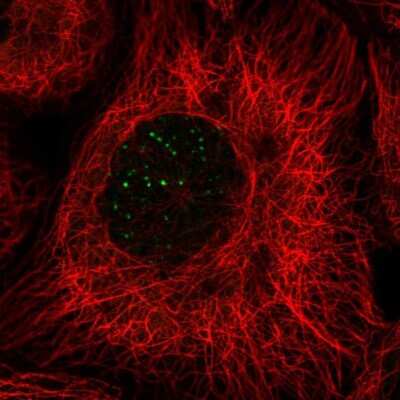 Immunocytochemistry/Immunofluorescence: MERIT40/HSPC142 Antibody [NBP2-58126] - Staining of human cell line A-431 shows localization to nuclear bodies.