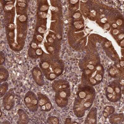 Immunohistochemistry: MERIT40/HSPC142 Antibody [NBP2-49568] - Staining of human small intestine shows moderate cytoplasmic positivity in glandular cells.