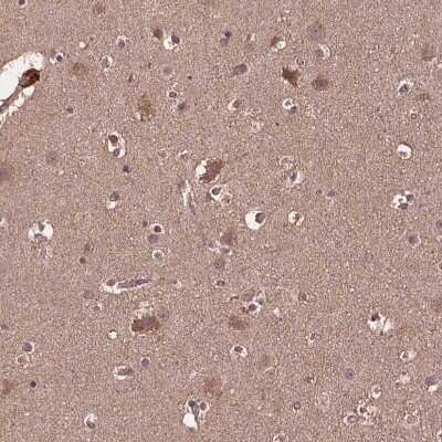 Immunohistochemistry-Paraffin: MERIT40/HSPC142 Antibody [NBP2-49568] - Staining of human cerebral cortex shows weak to moderate cytoplasmic positivity in neurons.