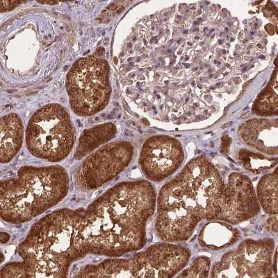 Immunohistochemistry-Paraffin: MERIT40/HSPC142 Antibody [NBP2-49568] - Staining of human kidney shows strong cytoplasmic positivity in cells in tubules.