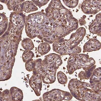 Immunohistochemistry-Paraffin: MERIT40/HSPC142 Antibody [NBP2-49568] - Staining of human placenta shows moderate cytoplasmic positivity in trophoblastic cells.