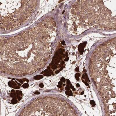 Immunohistochemistry-Paraffin: MERIT40/HSPC142 Antibody [NBP2-49568] - Staining of human testis shows strong cytoplasmic positivity in Leydig cells.