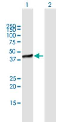 Western Blot: MERIT40/HSPC142 Antibody [H00029086-B01P] - Analysis of C19orf62 expression in transfected 293T cell line by C19orf62 polyclonal antibody.  Lane 1: HSPC142 transfected lysate(36.19 KDa). Lane 2: Non-transfected lysate.