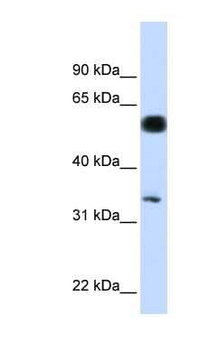 Western Blot: MERIT40/HSPC142 Antibody [NBP1-56773] - Hela cell lysate, concentration 0.2-1 ug/ml.