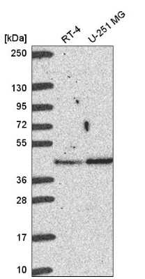 Western Blot: MERIT40/HSPC142 Antibody [NBP2-58126] - Western blot analysis in human cell line RT-4 and human cell line U-251 MG.