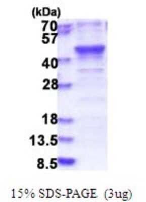 SDS-Page: MERIT40/HSPC142 Recombinant Protein [NBP2-51793] - 15% SDS Page (3 ug)