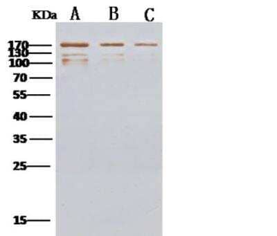 Western Blot MERS-CoV Spike Protein Antibody