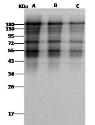 Western Blot: MERS-CoV Spike Protein Antibody [NBP3-06408] - MERS-CoV Spike Protein antibody at 1:1000 dilution. Sample: MERS-CoV Spike protein (ECD, aa 1-1297). Lane A: 5ng Lane B: 2ng Lane C: 1ng. Secondary: Goat Anti-Rabbit IgG (H+L)/HRP at 1/10000 dilution. Developed using the ECL technique. Performed under reducing conditions.