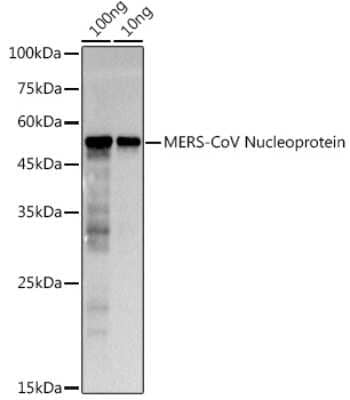 Western Blot: MERS-CoV Nucleoprotein Antibody [NBP3-16057] - Analysis of extracts of MERS-CoV Nucleoprotein, using MERS-CoV Nucleoprotein antibody (NBP3-16057) at 1:1000 dilution. Secondary antibody: HRP Goat Anti-Rabbit IgG (H+L) at 1:10000 dilution. Lysates/proteins: 25ug per lane. Blocking buffer: 3% nonfat dry milk in TBST. Detection: ECL Basic Kit. Exposure time: 0.5s.